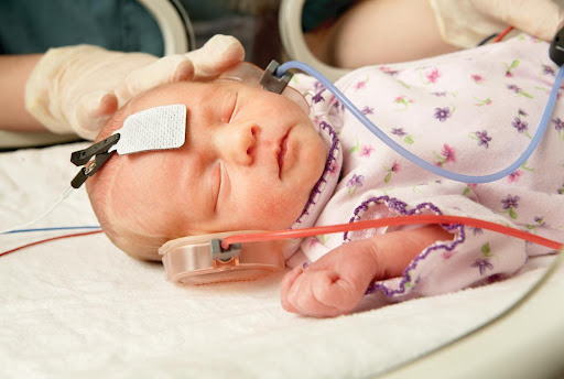 Newborn Hearing Screening
